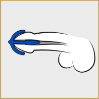 Preview: Penisplug Sperm Anchor