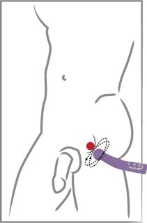 Prostate Twister zum Prostata melken Prostate Twister zum Prostata melken